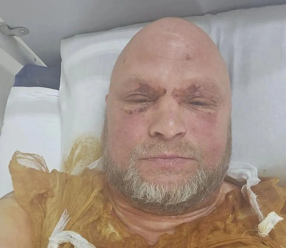 Во время приготовления в популярном афганском казане посуда лопнула: внутри было около 12 кг мяса. Взрыв едва не привёл к трагедии для семьи шеф‑повара, участвовавшего в шоу «На ножах». Подробности инцидента уточняются.
