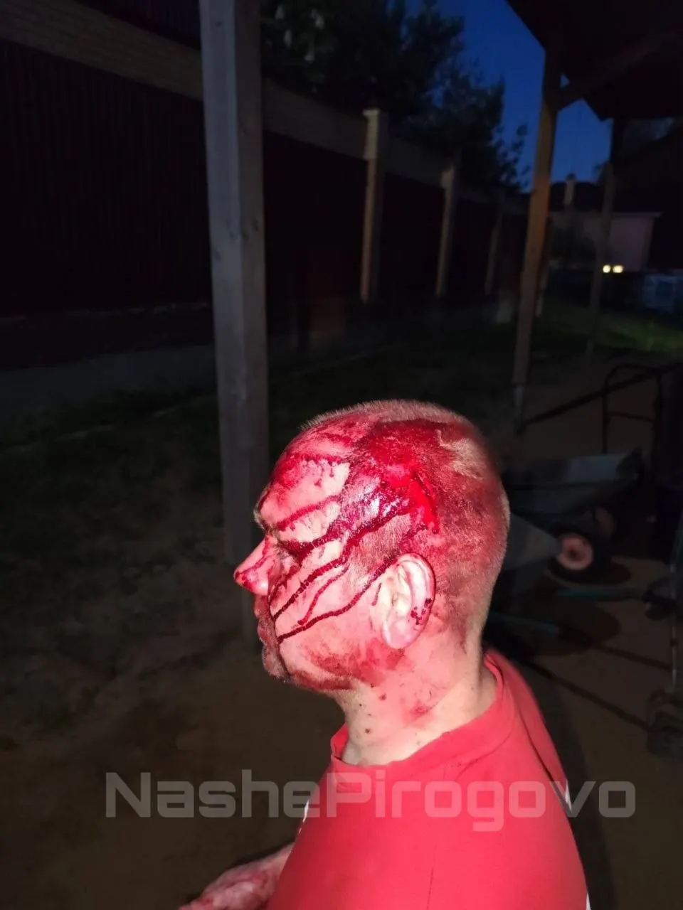 В деревне Пирогово (Мытищинский округ) директор местного завода пришёл на частную территорию соседа с вилами, напал на охранявшую двор овчарку и затем избил самого активиста. Пострадавший находится в больнице, соседи требуют объективного расследования.