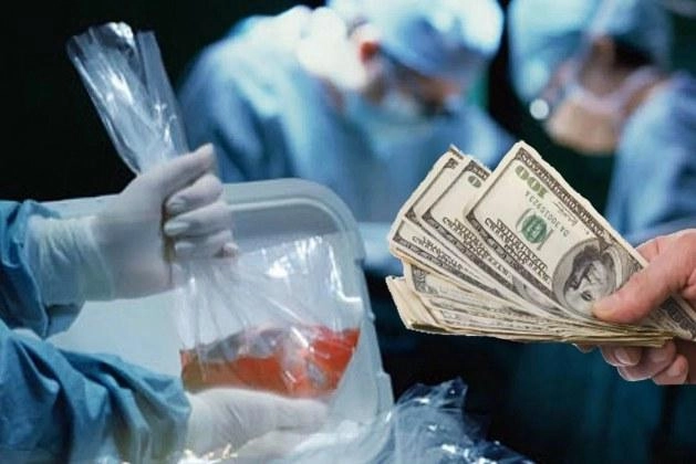 Басманный суд Москвы рассмотрит уголовное дело в отношении гражданина Израиля Бориса Вольфмана, которого следствие обвиняет в участии в международной схеме изъятия и продажи почек через клинику Medicus в Косово.
