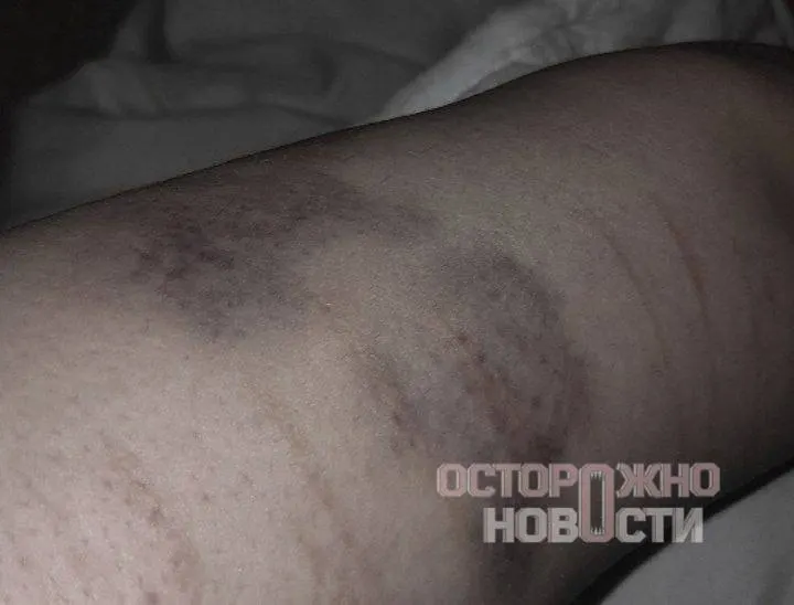 Мужчина, находившийся в автозаке рядом со стримером, утверждает, что сотрудники ОМОНа избивали задержанных, применяли электрошокер и оскорбляли людей; среди задержанных были несовершеннолетние.