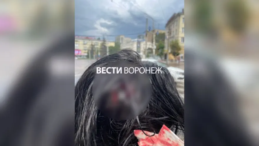 Во время непогоды с фасада дома на Кольцовской упал кусок лепнины, который попал в голову прохожей. Пострадавшая получила сотрясение и собирается требовать компенсацию, управляющая компания пока не комментирует.