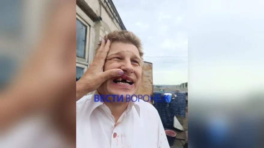 8 июля утром на улице Хользунова в Воронеже неизвестный напал на мужчину с инвалидностью. Пострадавший получил многочисленные травмы; прокуратура организовала проверку и совместно с полицией ищет нападавшего.