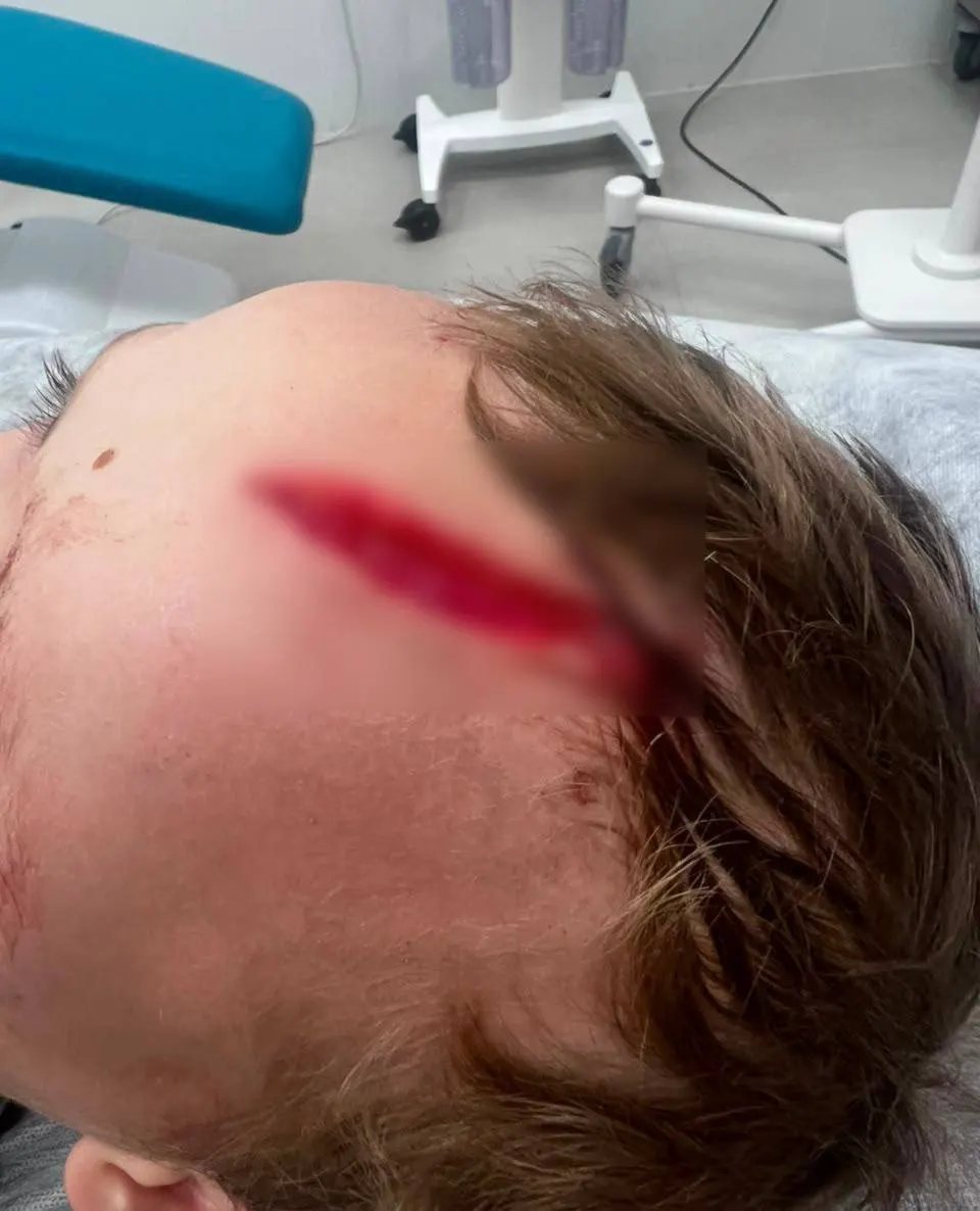 В деревне Дубцы Одинцовского района семилетнего мальчика атаковала собака; его спас прохожий, ребёнок госпитализирован в клинику Рошаля, местные жаловались на агрессивное животное ранее.